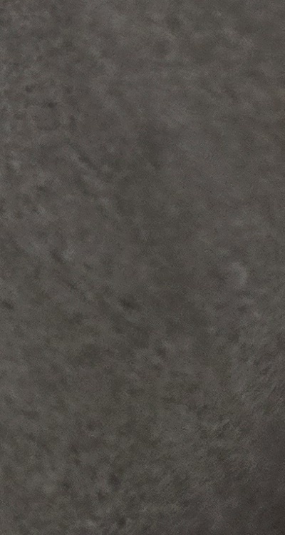 반대교합 치아교정 해결 가능할까 관련 이미지 47