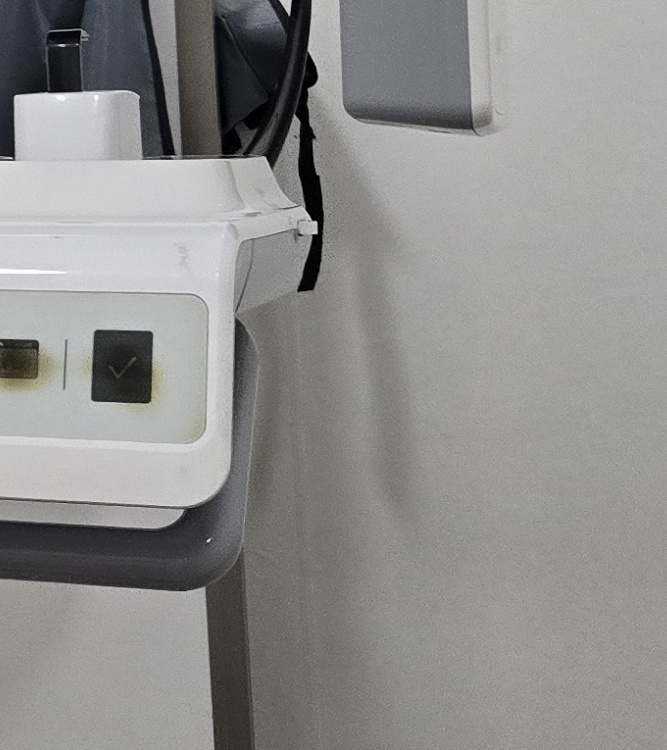 치경부마모증 치료 과정 신중하게 준비하려면 관련 이미지 27