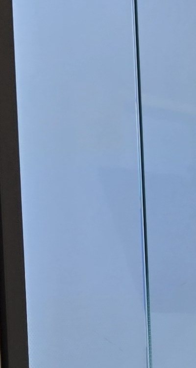 아말감 교체 레진 인레이 어떻게 대처하면 될까 관련 이미지 25