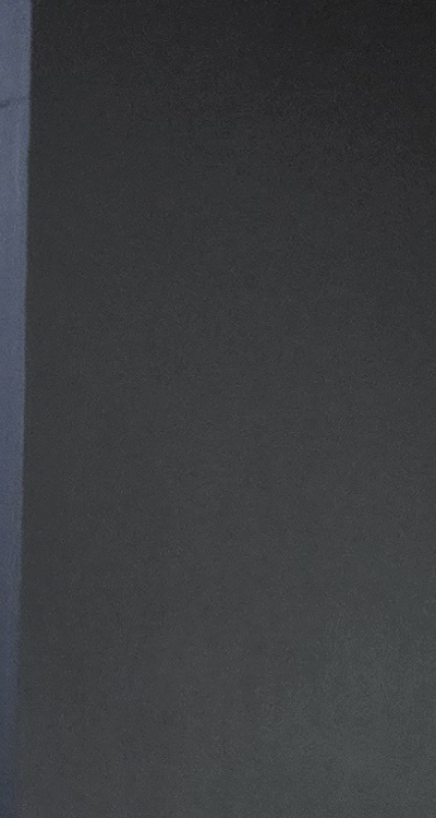 치아 발치 후 임플란트 언제부터 준비할까 관련 이미지 19