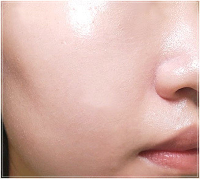 홍조화장품 뽀얗게 피부 진정 시키기 관련 이미지 9
