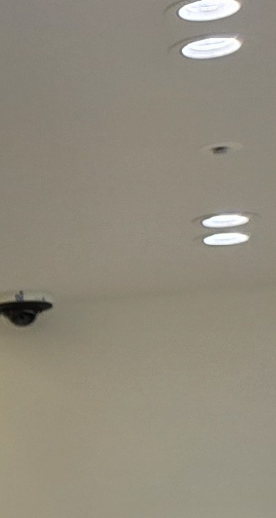 앞니 신경치료 크라운 까지 해야할 상황이라면 관련 이미지 30