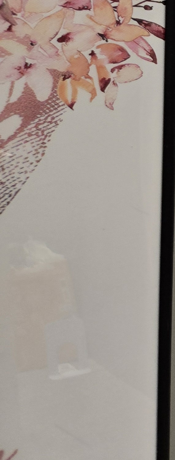 비발치 돌출입 교정 어떨때 적절할까 관련 이미지 29