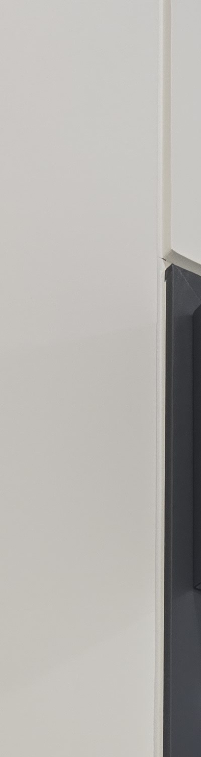 앞니 크라운 교체 깔끔하게 정리하려면 관련 이미지 12