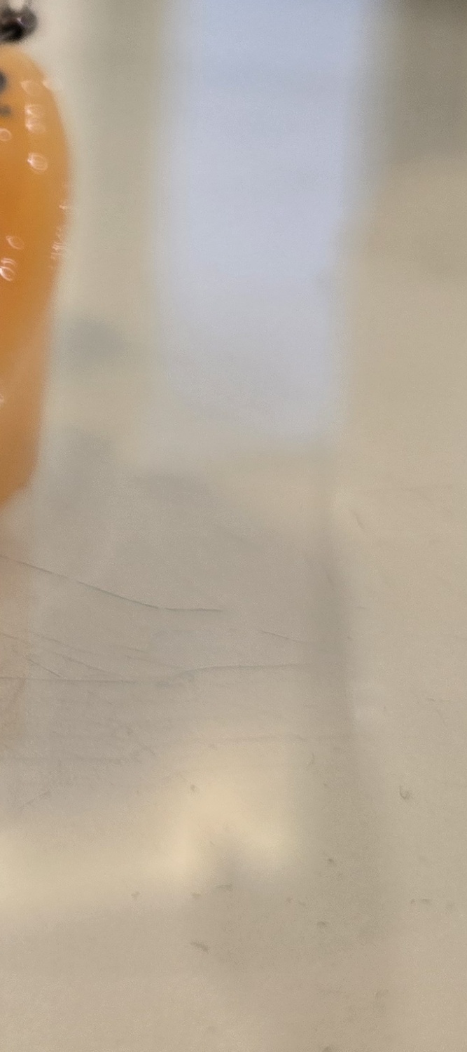 송곳니 덧니 발치 이럴때 해당되네요 관련 이미지 22