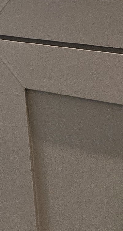 인레이 치료 후 통증 자꾸 심해지는데 괜찮은걸까 관련 이미지 49