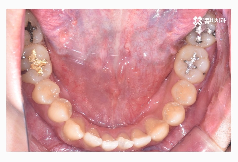 콤비교정 올바르게 판단하려면 관련 이미지 5