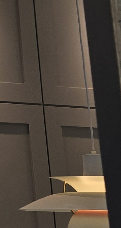 반대교합 치아교정 해결 가능할까 관련 이미지 35