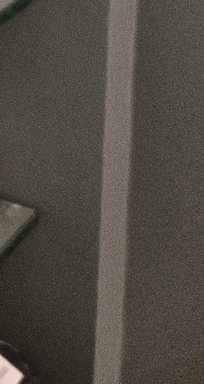 사랑니 주변 잇몸 통증 지금부터가 중요하니까 관련 이미지 51