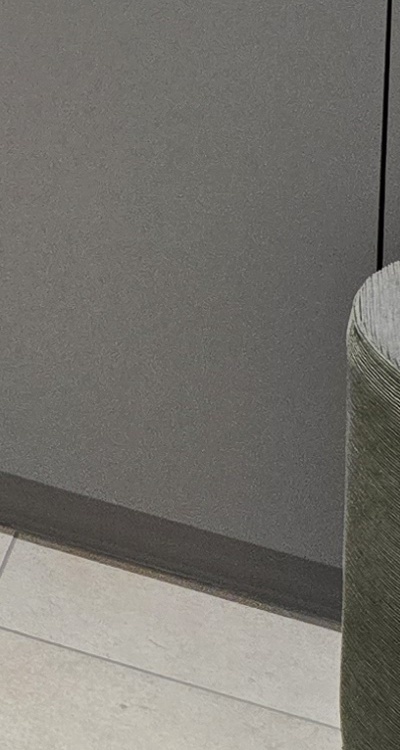 아래 사랑니 발치 통증 미리 알고 대처하려면 관련 이미지 46