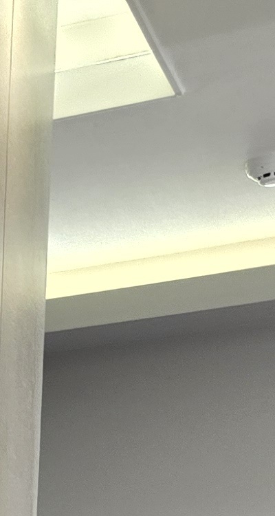 임플란트의 장점 할까 말까 고민이신 분들을 위한 정리 관련 이미지 17