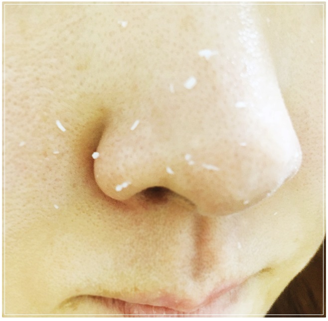 모공수축 쉽게하는방법 관련 이미지 5