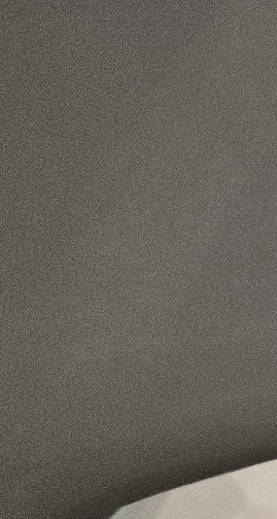 사랑니 주변 잇몸 통증 지금부터가 중요하니까 관련 이미지 33