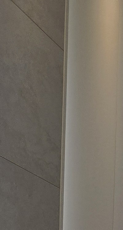 앞니 틀어짐 교정 조화롭게 마무리하려면 관련 이미지 15