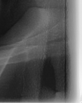어금니 뒤 잇몸 부음 어떤 문제길래 이런거죠 관련 이미지 47