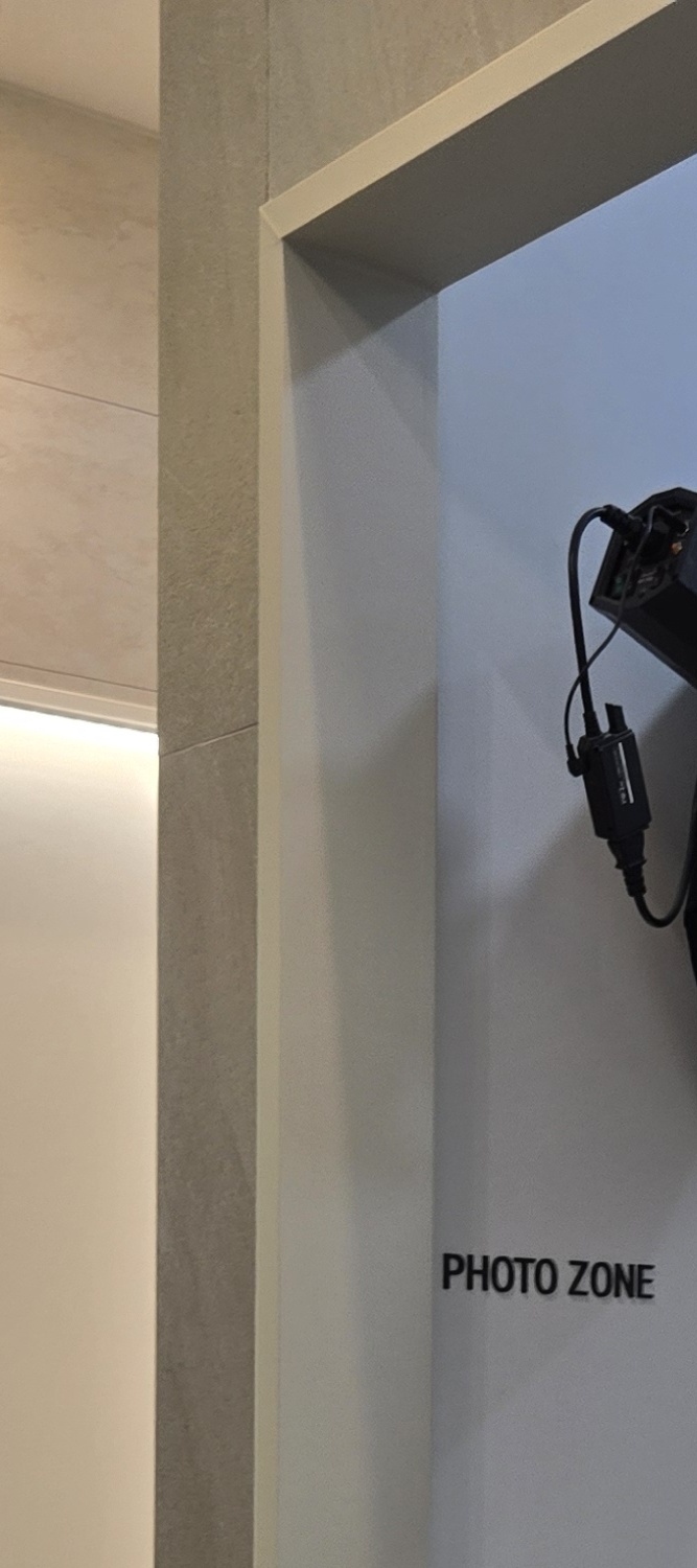 뼈이식 임플란트 수명 깐깐하게 파악하려면 관련 이미지 27