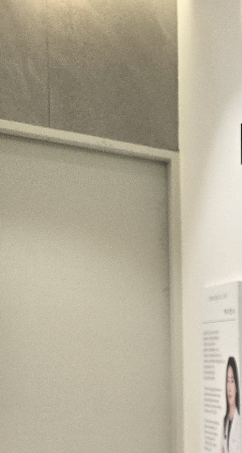 오래된 보철물 아말감 교체 어떠한 케이스일까 관련 이미지 22