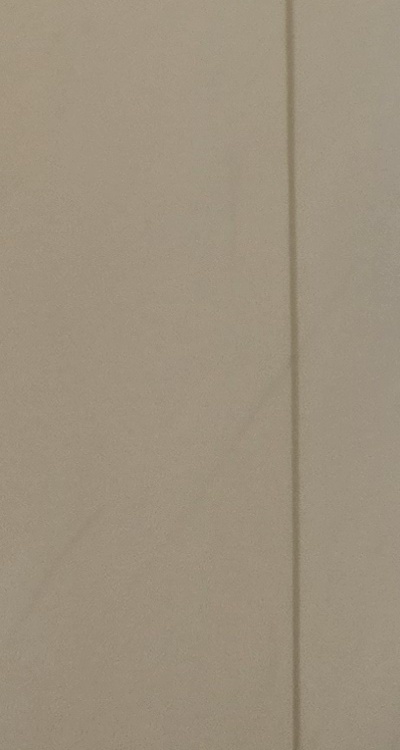 클리피씨교정 장단점 어떻게 비교하면 될까요 관련 이미지 42