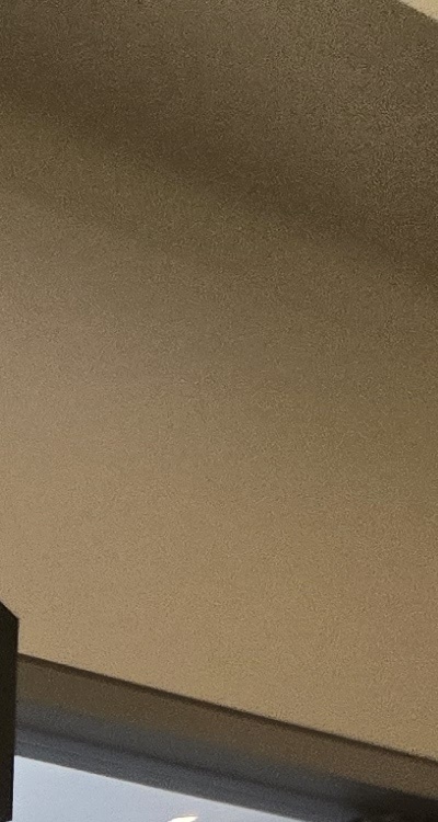 사랑니 발치 후 충치 치료 둘다 준비하려면 관련 이미지 20