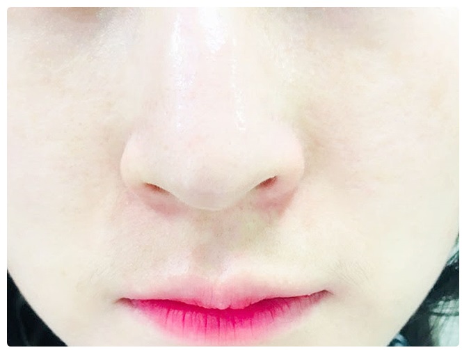 코피지제거 필요할 때는 관련 이미지 5