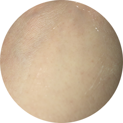 화이트닝크림추천 여름에도 뽀샤시하게 관련 이미지 10