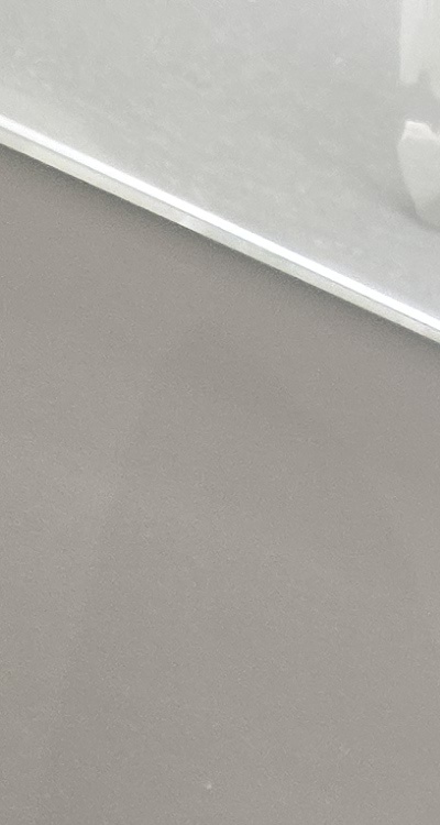 앞니 틀어짐 부분교정 얼마나 걸릴까 관련 이미지 15