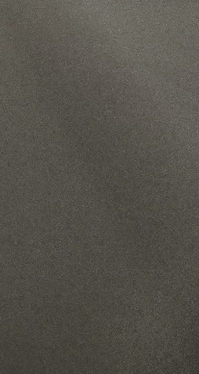 완전매복사랑니 발치 대학병원 꼭 가야하나요 관련 이미지 48