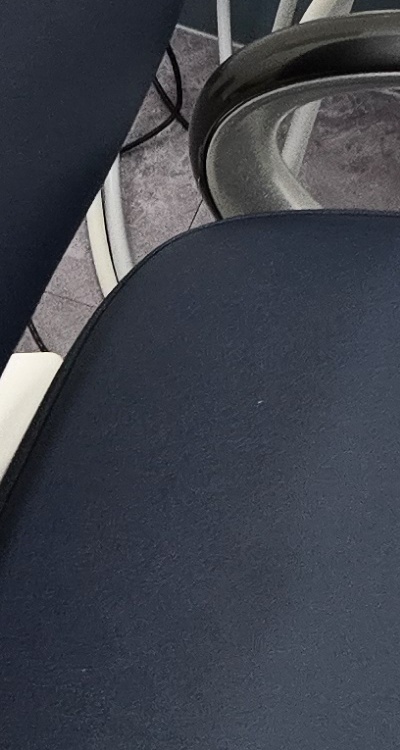 치아 사이 벌어짐 심해지는 이유부터 알아보면 관련 이미지 33