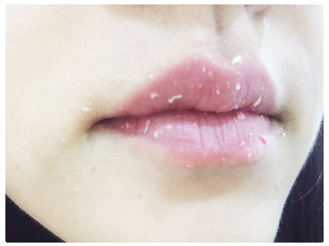 여드름화장품 새로 나온 클렌징패드 써봐! 관련 이미지 7