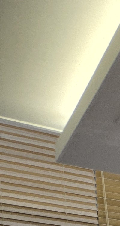 임플란트 뼈이식 안하면 어떤 문제가 있는거죠 관련 이미지 13