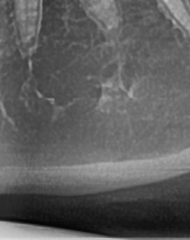 어금니 뒤 잇몸 부음 어떤 문제길래 이런거죠 관련 이미지 44