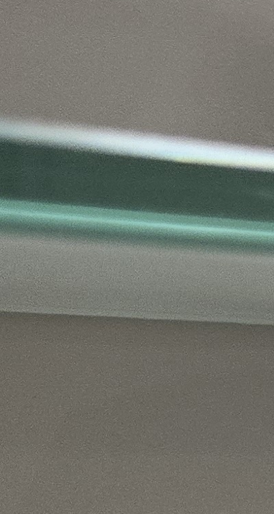 앞니 틀어짐 부분교정 얼마나 걸릴까 관련 이미지 22