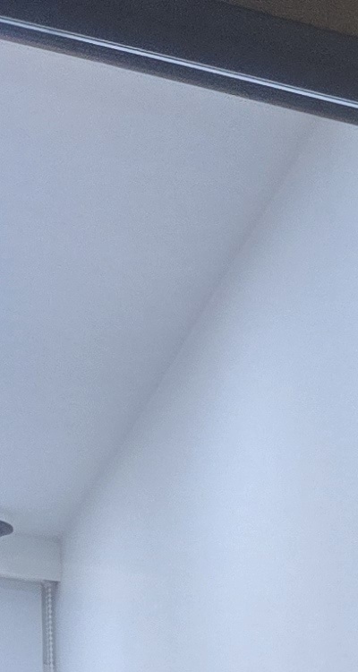 사랑니 발치 후 충치 치료 둘다 준비하려면 관련 이미지 13