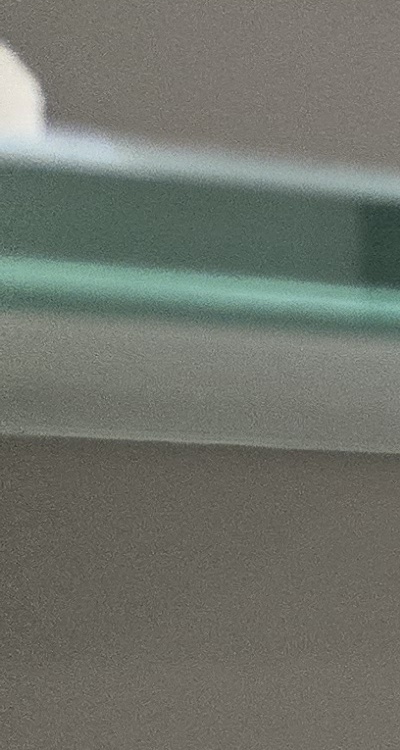 앞니 틀어짐 부분교정 얼마나 걸릴까 관련 이미지 21