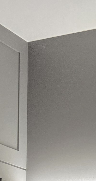 아래 사랑니 발치 통증 미리 알고 대처하려면 관련 이미지 13