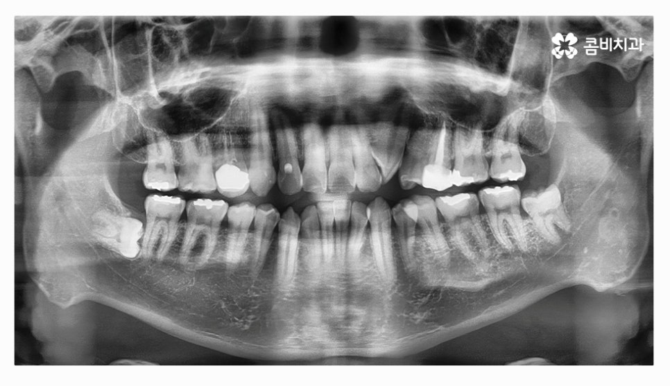 클리피씨교정 올바르게 판단하려면 관련 이미지 6