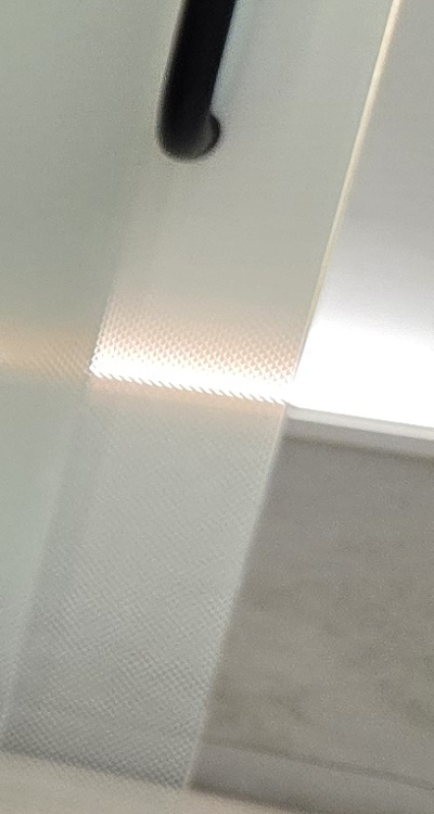 신경치료 아픈가요 망설이시는 분들이라면 관련 이미지 30