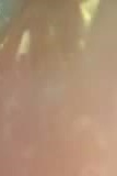 어금니 임플란트 수명 어느정도나 지속될까 관련 이미지 25