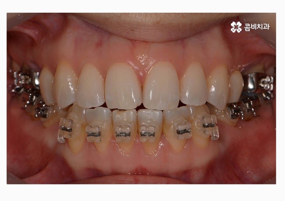 콤비교정 합리적으로 판단하려면 관련 이미지 8