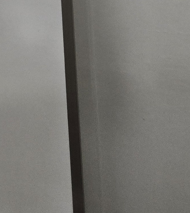 치경부마모증 치료 과정 신중하게 준비하려면 관련 이미지 33