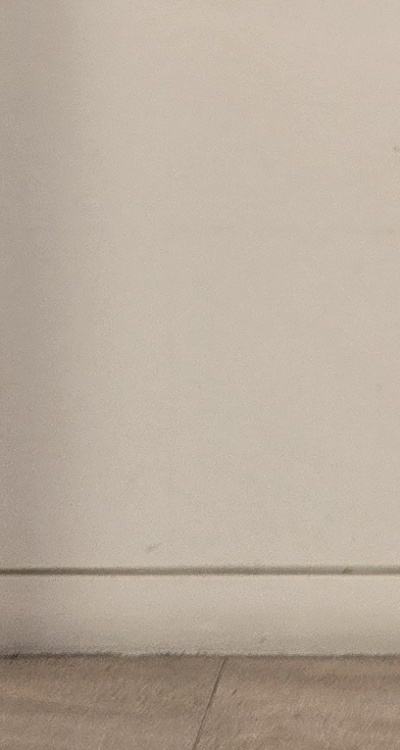 앞니 올세라믹 이건 알고 시작하세요 관련 이미지 43