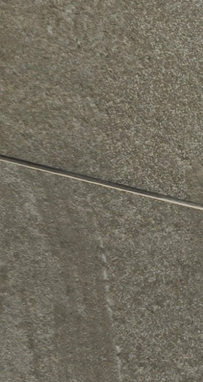 앞니 신경치료 크라운 까지 해야할 상황이라면 관련 이미지 22