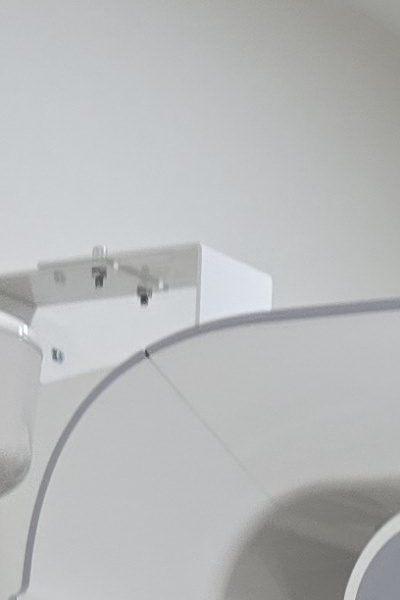 부정교합 교정 안하면 생기는 문제는 뭔가요 관련 이미지 23