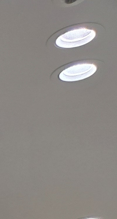 앞니 신경치료 크라운 까지 해야할 상황이라면 관련 이미지 20