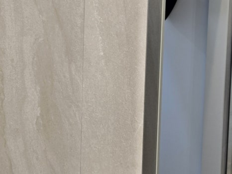 65세이상 임플란트 개수 구체적으로 체크하려면 관련 이미지 23