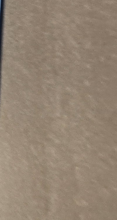 앞니 올세라믹 이건 알고 시작하세요 관련 이미지 39