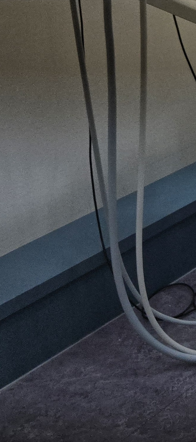 뼈이식 임플란트 수명 깐깐하게 파악하려면 관련 이미지 20
