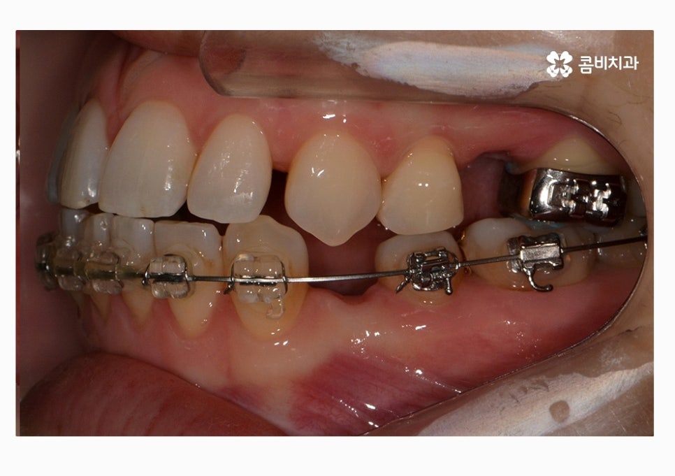 콤비교정 합리적으로 판단하려면 관련 이미지 11