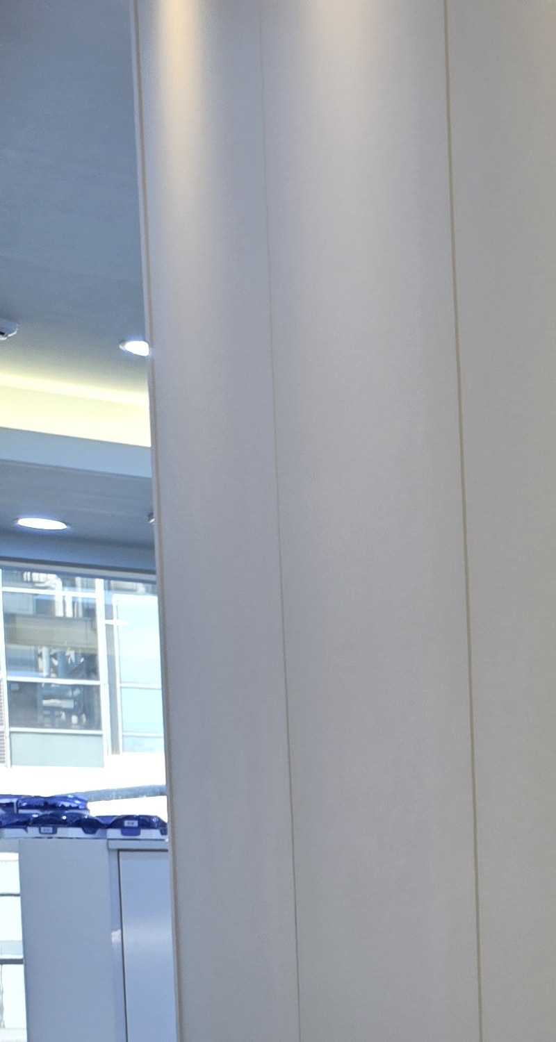 어금니 임플란트 과정 제대로 이해하려면 관련 이미지 13