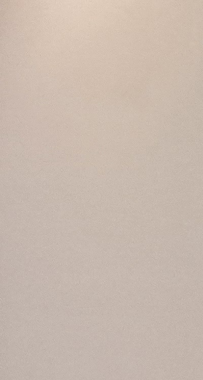 앞니 올세라믹 이건 알고 시작하세요 관련 이미지 10